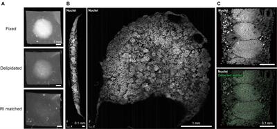 Perspective: Extending the Utility of Three-Dimensional Organoids by Tissue Clearing Technologies